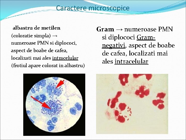 Caractere microscopice albastru de metilen (coloratie simpla) → numeroase PMN si diplococi, aspect de