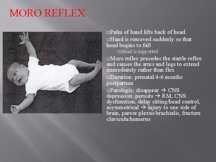 MORO REFLEX Palm of hand lifts back of head Hand is removed suddenly so