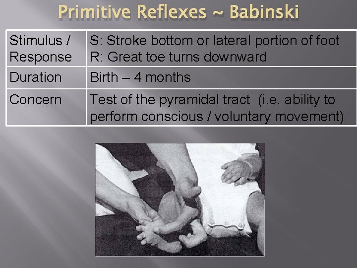 Primitive Reflexes ~ Babinski Stimulus / Response Duration S: Stroke bottom or lateral portion