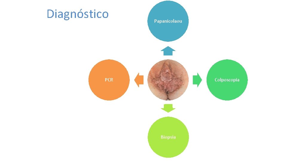 Diagnóstico Papanicolaou PCR Colposcopia Biopsia 