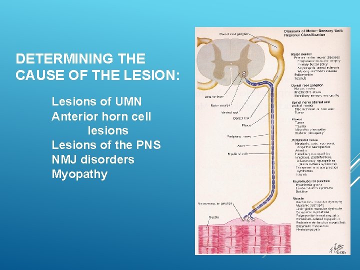 DETERMINING THE CAUSE OF THE LESION: Lesions of UMN Anterior horn cell lesions Lesions