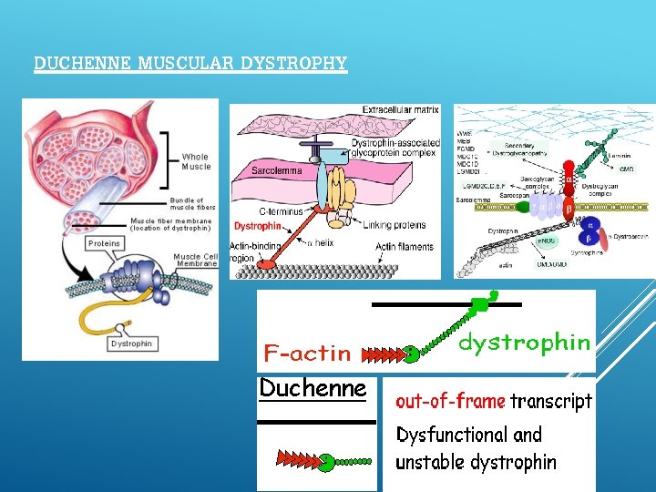 DUCHENNE MUSCULAR DYSTROPHY 
