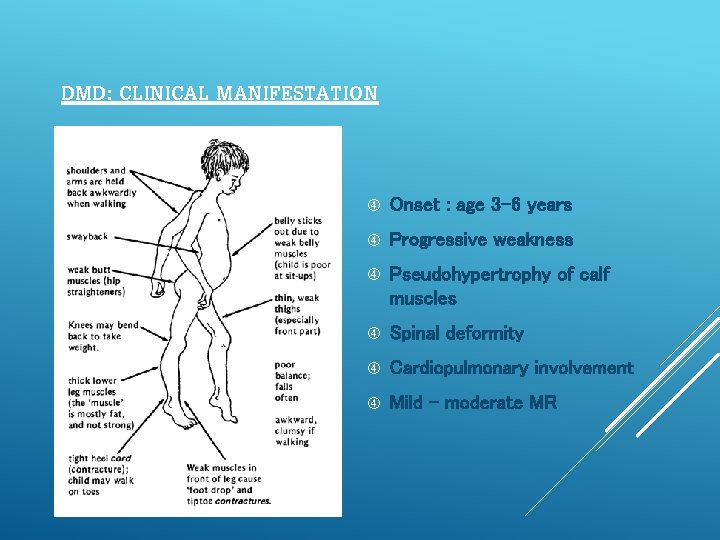 DMD: CLINICAL MANIFESTATION Onset : age 3 -6 years Progressive weakness Pseudohypertrophy of calf