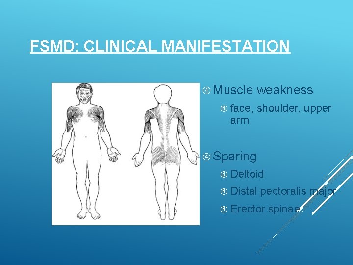 FSMD: CLINICAL MANIFESTATION Muscle weakness face, shoulder, upper arm Sparing Deltoid Distal pectoralis major
