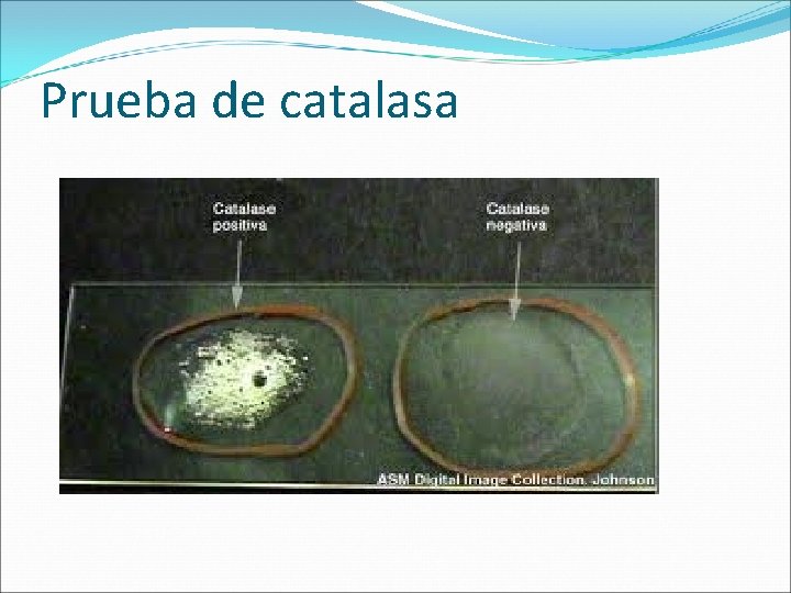 Prueba de catalasa 