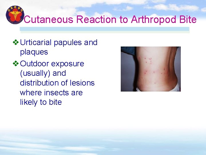 Cutaneous Reaction to Arthropod Bite v Urticarial papules and plaques v Outdoor exposure (usually) Cutaneous Reaction to Arthropod Bite v Urticarial papules and plaques v Outdoor exposure (usually)