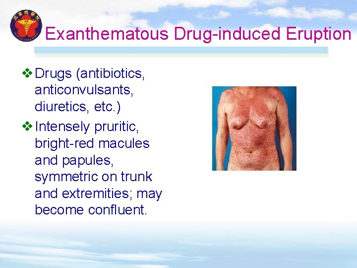 Exanthematous Drug-induced Eruption v Drugs (antibiotics, anticonvulsants, diuretics, etc. ) v Intensely pruritic, bright-red Exanthematous Drug-induced Eruption v Drugs (antibiotics, anticonvulsants, diuretics, etc. ) v Intensely pruritic, bright-red