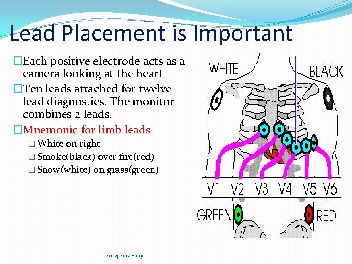 Lead Placement is Important �Each positive electrode acts as a camera looking at the