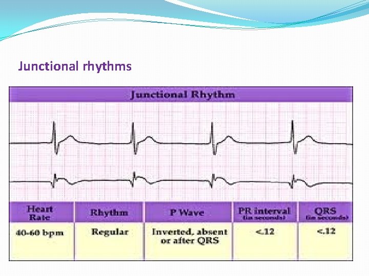 Junctional rhythms 