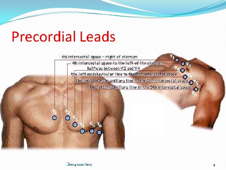 Precordial Leads � 2004 Anna Story 4 