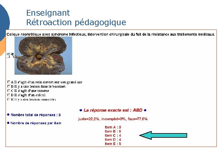 Enseignant Rétroaction pédagogique 