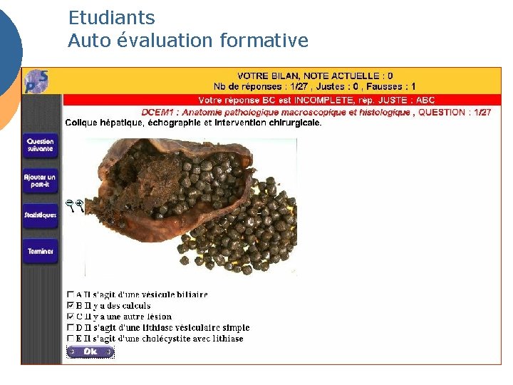 Etudiants Auto évaluation formative 