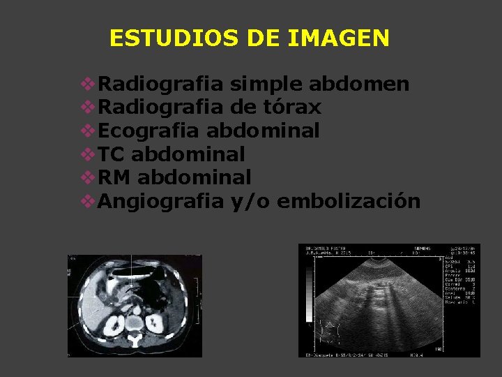 ESTUDIOS DE IMAGEN v. Radiografia simple abdomen v. Radiografia de tórax v. Ecografia abdominal