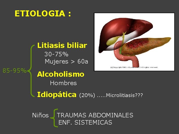ETIOLOGIA : Litiasis biliar 30 -75% Mujeres > 60 a 85 -95% Alcoholismo Hombres