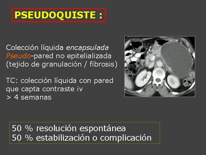 PSEUDOQUISTE : Colección líquida encapsulada Pseudo-pared no epitelializada (tejido de granulación / fibrosis) TC: