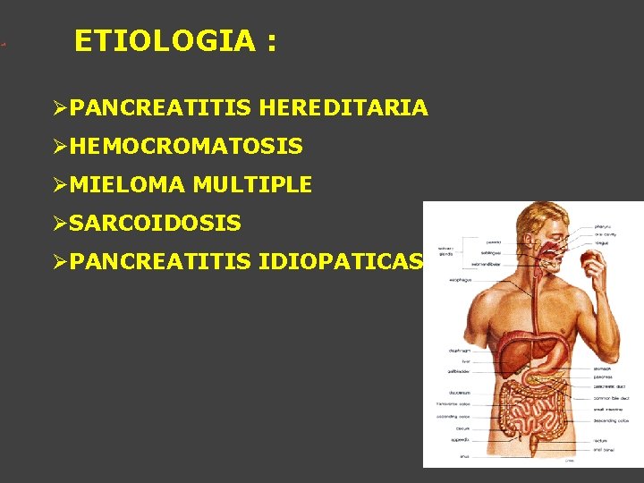 ETIOLOGIA : ØPANCREATITIS HEREDITARIA ØHEMOCROMATOSIS ØMIELOMA MULTIPLE ØSARCOIDOSIS ØPANCREATITIS IDIOPATICAS 