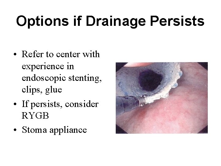Options if Drainage Persists • Refer to center with experience in endoscopic stenting, clips,