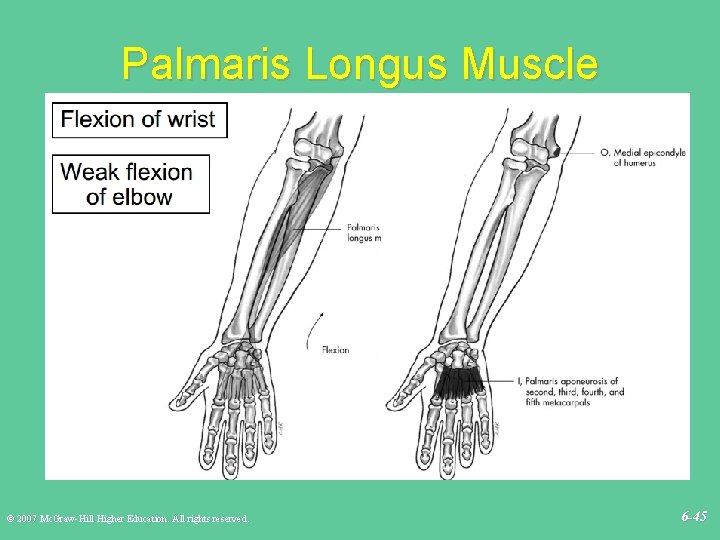 Palmaris Longus Muscle © 2007 Mc. Graw-Hill Higher Education. All rights reserved. 6 -45
