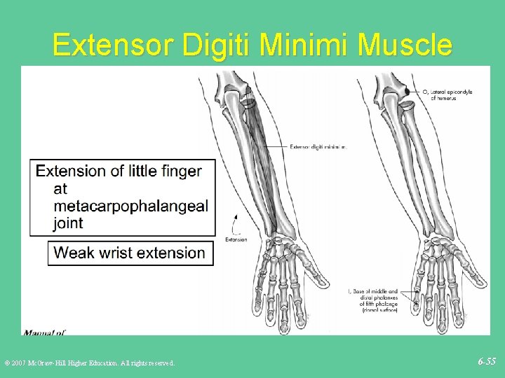 Extensor Digiti Minimi Muscle © 2007 Mc. Graw-Hill Higher Education. All rights reserved. 6