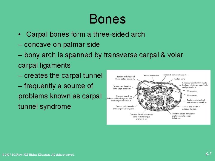 Bones • Carpal bones form a three-sided arch – concave on palmar side –