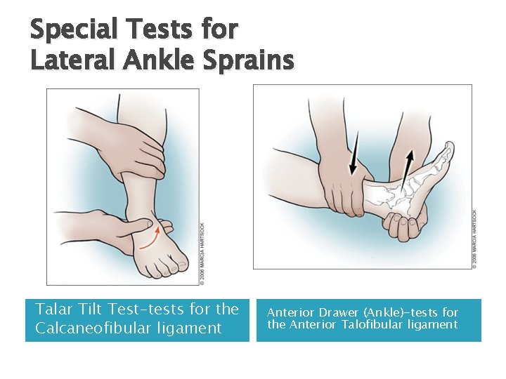 Special Tests for Lateral Ankle Sprains Talar Tilt Test-tests for the Calcaneofibular ligament Anterior