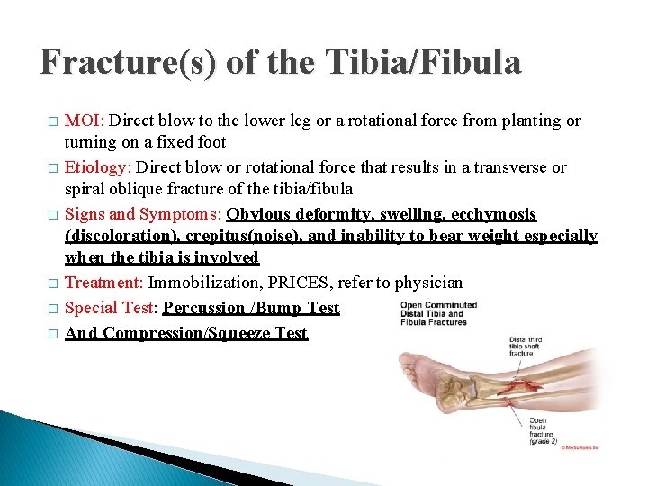 Fracture(s) of the Tibia/Fibula � � � MOI: Direct blow to the lower leg