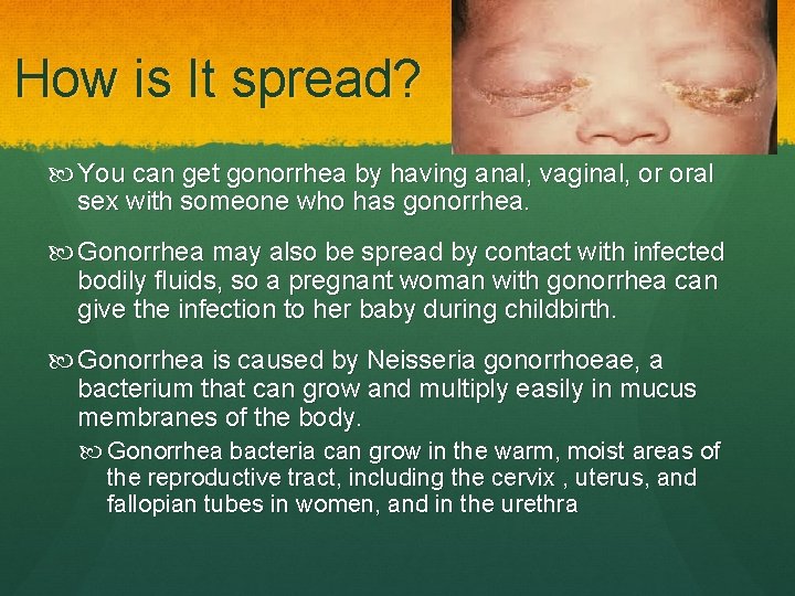 How is It spread? You can get gonorrhea by having anal, vaginal, or oral