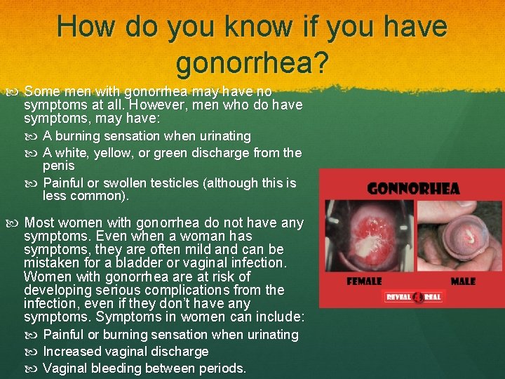 How do you know if you have gonorrhea? Some men with gonorrhea may have