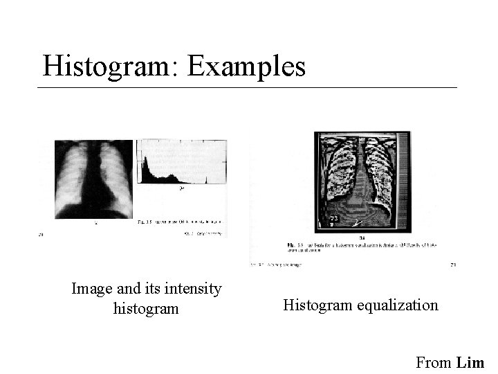 Histogram: Examples Image and its intensity histogram Histogram equalization From Lim 