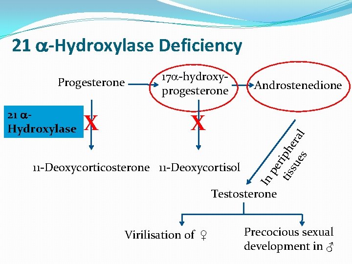 21 -Hydroxylase Deficiency 21 Hydroxylase X 17 -hydroxyprogesterone X In 11 -Deoxycorticosterone 11 -Deoxycortisol