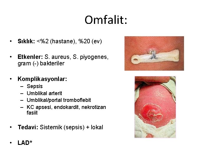 Omfalit: • Sıklık: <%2 (hastane), %20 (ev) • Etkenler: S. aureus, S. piyogenes, gram
