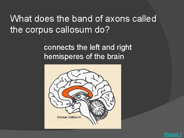 What does the band of axons called the corpus callosum do? connects the left