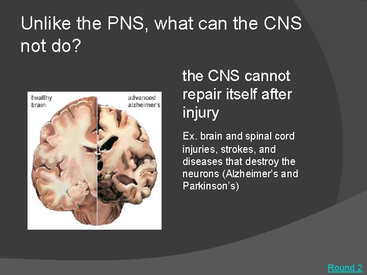 Unlike the PNS, what can the CNS not do? the CNS cannot repair itself
