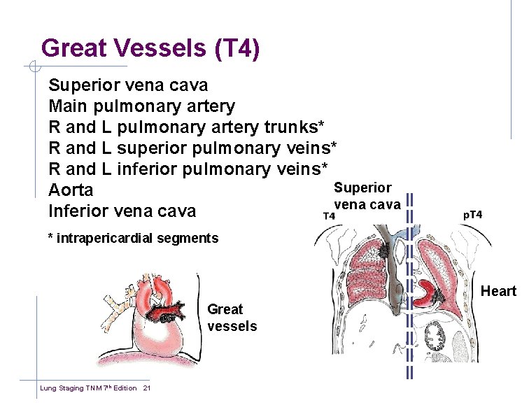 Great Vessels (T 4) Superior vena cava Main pulmonary artery R and L pulmonary