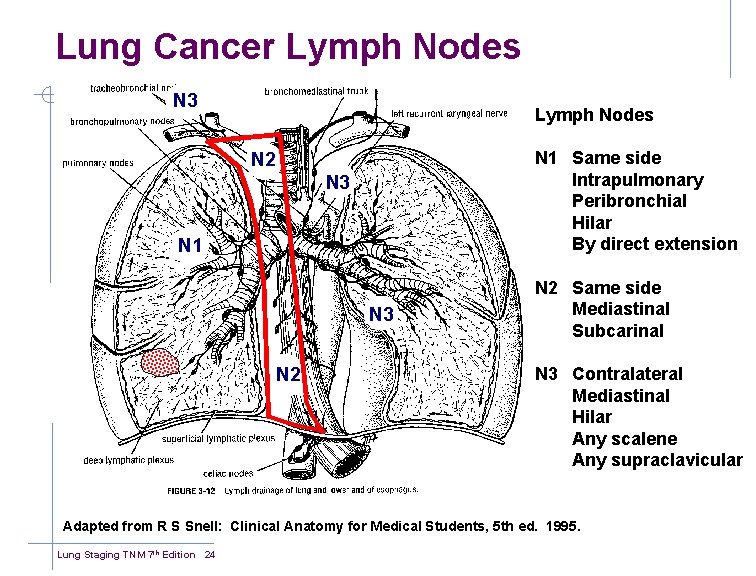 Lung Cancer Lymph Nodes N 3 Lymph Nodes N 1 Same side Intrapulmonary Peribronchial