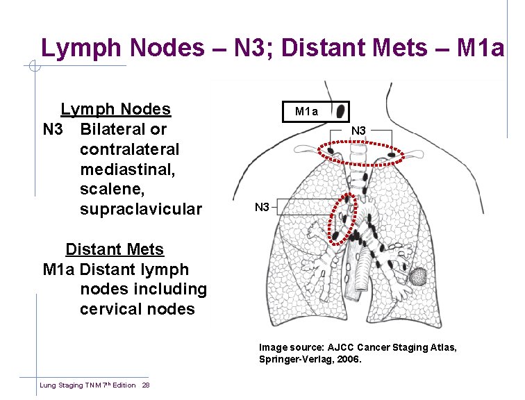 Lymph Nodes – N 3; Distant Mets – M 1 a Lymph Nodes N