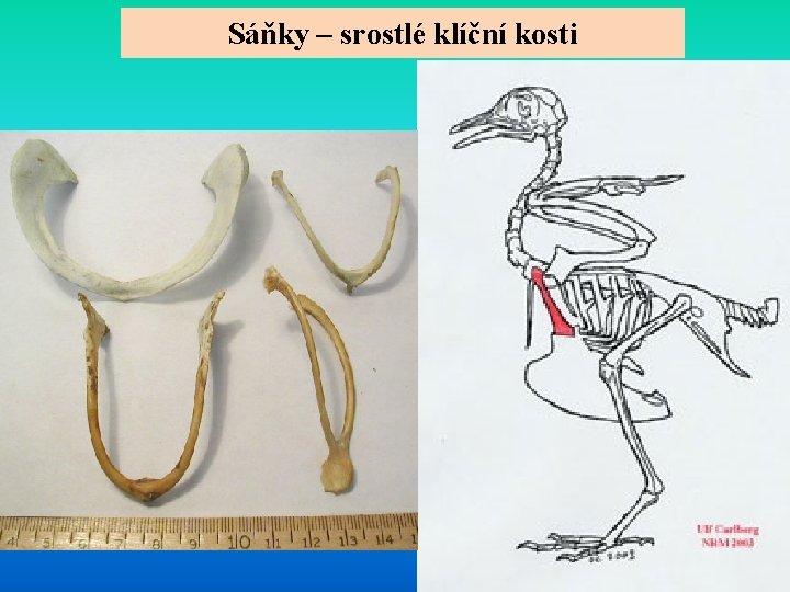 Sáňky – srostlé klíční kosti 