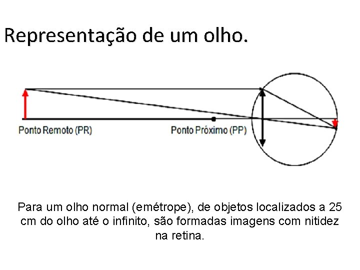 Representação de um olho. Para um olho normal (emétrope), de objetos localizados a 25