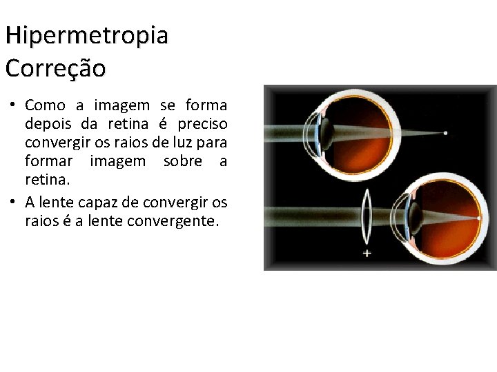 Hipermetropia Correção • Como a imagem se forma depois da retina é preciso convergir