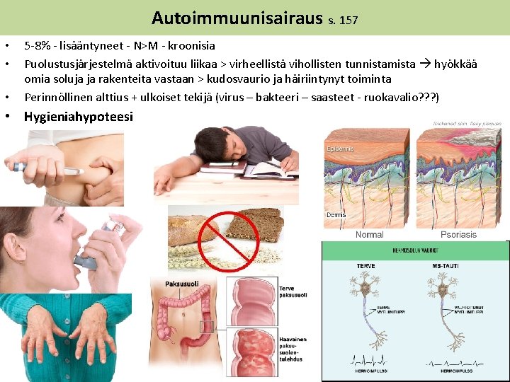 Autoimmuunisairaus s. 157 • • • 5 -8% - lisääntyneet - N>M - kroonisia