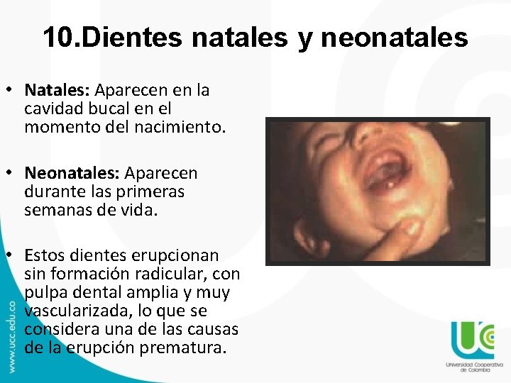 10. Dientes natales y neonatales • Natales: Aparecen en la cavidad bucal en el 10. Dientes natales y neonatales • Natales: Aparecen en la cavidad bucal en el