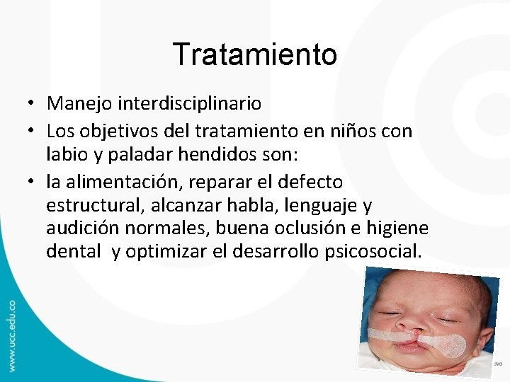 Tratamiento • Manejo interdisciplinario • Los objetivos del tratamiento en niños con labio y Tratamiento • Manejo interdisciplinario • Los objetivos del tratamiento en niños con labio y