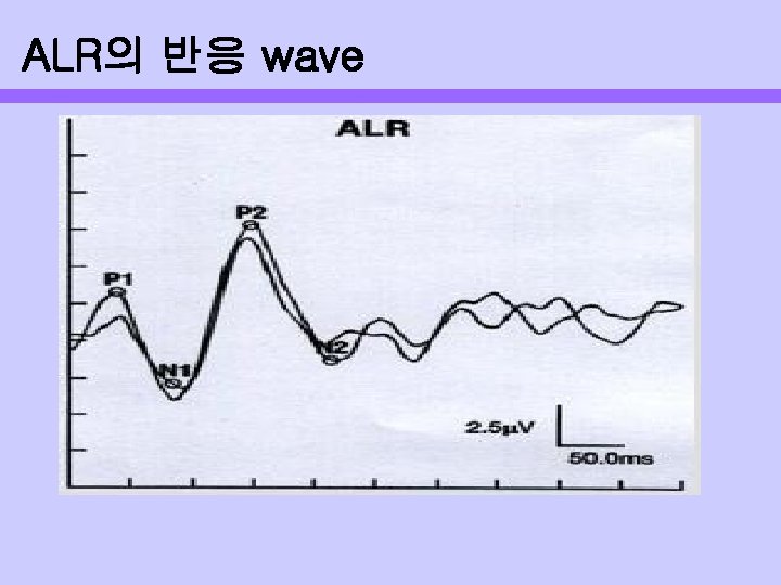 ALR의 반응 wave 