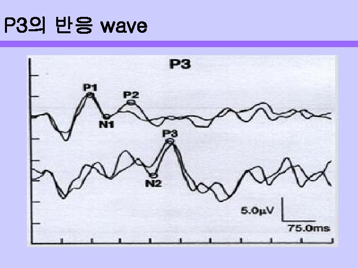 P 3의 반응 wave 