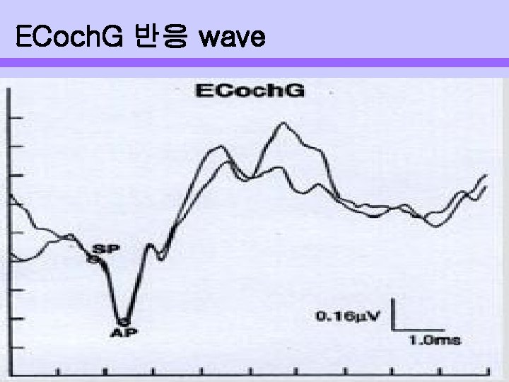 ECoch. G 반응 wave 