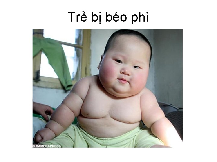 Trẻ bị béo phì 