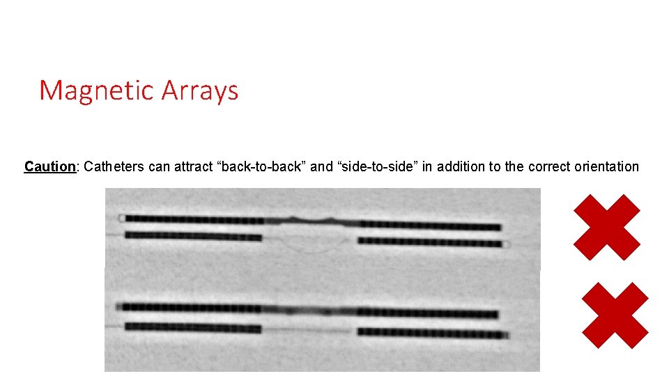 Magnetic Arrays Caution: Catheters can attract “back-to-back” and “side-to-side” in addition to the correct Magnetic Arrays Caution: Catheters can attract “back-to-back” and “side-to-side” in addition to the correct