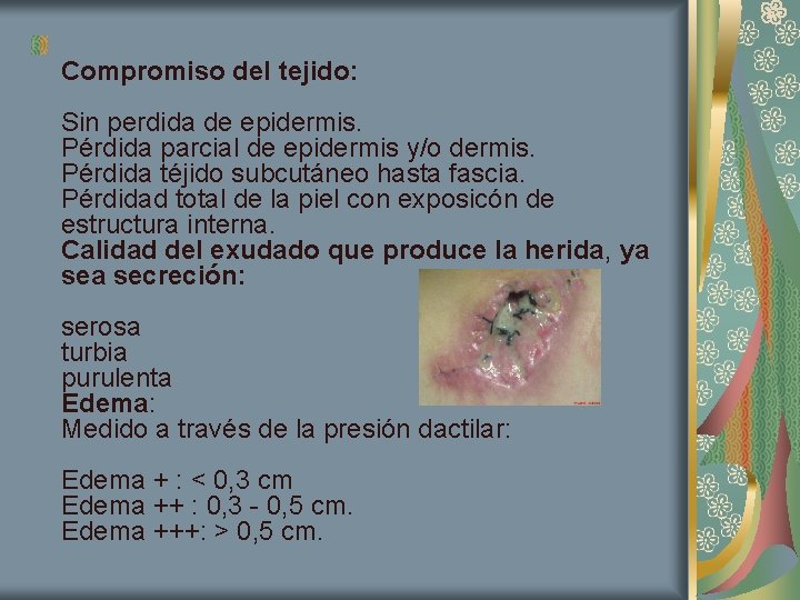 Compromiso del tejido: Sin perdida de epidermis. Pérdida parcial de epidermis y/o dermis. Pérdida