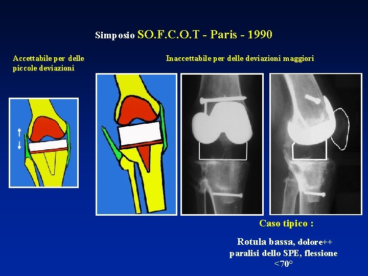 Simposio SO. F. C. O. T Accettabile per delle piccole deviazioni - Paris -