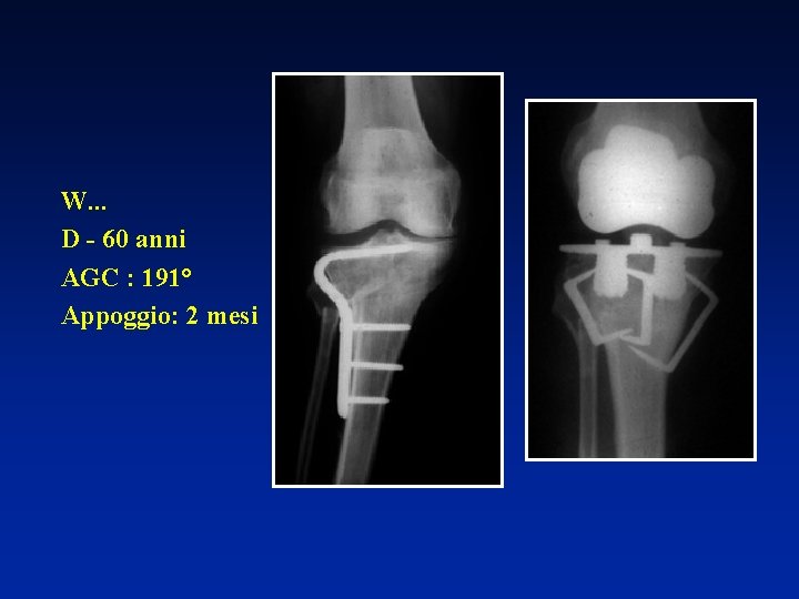 W. . . D - 60 anni AGC : 191° Appoggio: 2 mesi 